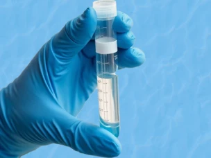 ВСЕМИРНЫЙ ДЕНЬ МОНИТОРИНГА КАЧЕСТВА ВОДЫ