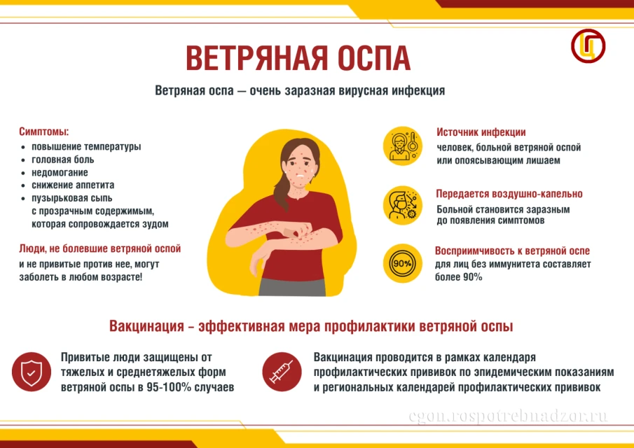 Ветряная оспа представляет собой острое вирусное инфекционное заболевание
